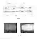 Fig. 05 - Microfluidic Analysis System
