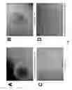 Fig. 02 - METHOD OF GENERATING NATURAL KILLER CELLS AND DENDRITIC CELLS FROM HUMAN EMBRYONIC STEM CELL-DERIVED HEMANGIOBLASTS