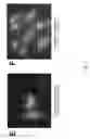 Fig. 03 - METHOD OF GENERATING NATURAL KILLER CELLS AND DENDRITIC CELLS FROM HUMAN EMBRYONIC STEM CELL-DERIVED HEMANGIOBLASTS