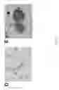 Fig. 05 - METHOD OF GENERATING NATURAL KILLER CELLS AND DENDRITIC CELLS FROM HUMAN EMBRYONIC STEM CELL-DERIVED HEMANGIOBLASTS