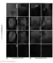 Fig. 16 - Lineage reprogramming to induced cardiac progenitor cells (iCPC) by defined factors