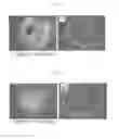 Fig. 04 - Method of producing induced pluripotent stem cells using inhibitors of P53