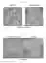 Fig. 20 - Method of producing induced pluripotent stem cells using inhibitors of P53