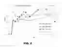 Fig. 03 - METHODS FOR DETECTING AMYLOID BETA AMYLOIDOSIS