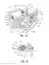 Fig. 08 - Exercising apparatus