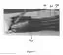 Fig. 07 - WEIGHTED SLEEVE