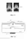 Fig. 08 - Active-source-pixel, integrated device for rapid analysis of biological and chemical specimens