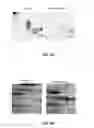 Fig. 05 - IN VITRO METHOD FOR DIAGNOSIS OF ENDOMETRIOSIS