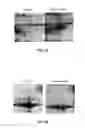 Fig. 06 - IN VITRO METHOD FOR DIAGNOSIS OF ENDOMETRIOSIS
