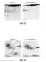 Fig. 07 - IN VITRO METHOD FOR DIAGNOSIS OF ENDOMETRIOSIS