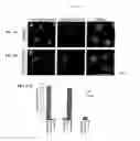 Fig. 07 - GENETIC MARKERS ASSOCIATED WITH INTELLECTUAL DISABILITY
