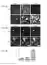 Fig. 06 - STIMULATION OF HUMAN MEIBOMIAN GLAND FUNCTION