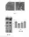 Fig. 07 - STIMULATION OF HUMAN MEIBOMIAN GLAND FUNCTION