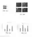 Fig. 09 - STIMULATION OF HUMAN MEIBOMIAN GLAND FUNCTION