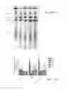Fig. 12 - STIMULATION OF HUMAN MEIBOMIAN GLAND FUNCTION
