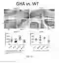Fig. 17 - STIMULATION OF HUMAN MEIBOMIAN GLAND FUNCTION