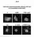 Fig. 05 - METHOD OF TREATING AND PREVENTING OCULAR ANGIOGENESIS