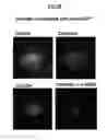 Fig. 07 - METHOD OF TREATING AND PREVENTING OCULAR ANGIOGENESIS