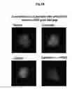 Fig. 09 - METHOD OF TREATING AND PREVENTING OCULAR ANGIOGENESIS