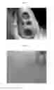 Fig. 04 - COMPOSITION FOR REPAIRING CARTILAGE TISSUE, METHOD FOR PRODUCING SAME, AND USE THEREOF