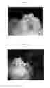 Fig. 06 - COMPOSITION FOR REPAIRING CARTILAGE TISSUE, METHOD FOR PRODUCING SAME, AND USE THEREOF