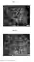 Fig. 09 - COMPOSITION FOR REPAIRING CARTILAGE TISSUE, METHOD FOR PRODUCING SAME, AND USE THEREOF