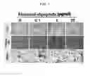 Fig. 02 - Bone loss preventing and bone regeneration or bone formation promoting pharmaceutical composition comprising muramyl dipeptide
