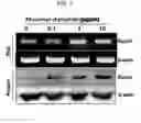 Fig. 03 - Bone loss preventing and bone regeneration or bone formation promoting pharmaceutical composition comprising muramyl dipeptide