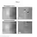 Fig. 08 - Bone loss preventing and bone regeneration or bone formation promoting pharmaceutical composition comprising muramyl dipeptide