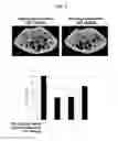 Fig. 10 - Bone loss preventing and bone regeneration or bone formation promoting pharmaceutical composition comprising muramyl dipeptide
