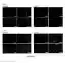 Fig. 37 - Methods of Treating Viral Associated Diseases