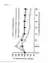 Fig. 04 - Treatment of respiratory depression