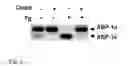 Fig. 02 - IRE-1α inhibitors