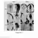 Fig. 06 - Method for modulating canonical Wnt pathway using folate and inositol