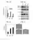 Fig. 11 - Methods of treating and diagnosing diseases using agents that regulate the alternative splicing pathway
