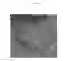 Fig. 03 - Emulsions or microemulsions for use in endoscopic mucosal resectioning and/or endoscopic submucosal dissection