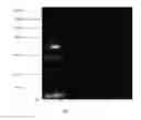 Fig. 09 - NEURAL SPECIFIC S100B FOR BIOMARKER ASSAYS AND DEVICES FOR DETECTION OF A NEUROLOGICAL CONDITION