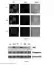 Fig. 04 - 2-phenyl benzothiazole linked imidazole compounds as potential anticancer agents and process for the preparation thereof