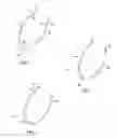 Fig. 02 - Methods for intra-abdominally moving and holding the liver away from the stomach