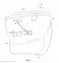 Fig. 03 - Methods for intra-abdominally moving and holding the liver away from the stomach