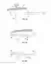 Fig. 07 - Methods for intra-abdominally moving and holding the liver away from the stomach