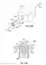 Fig. 32 - Methods for intra-abdominally moving and holding the liver away from the stomach
