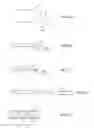 Fig. 33 - Methods for intra-abdominally moving and holding the liver away from the stomach