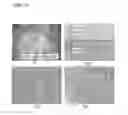 Fig. 20 - Image processing apparatus and endoscope