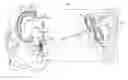 Fig. 01 - Flexible multiple-arm diagnostic catheter