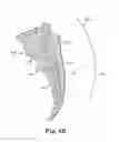 Fig. 07 - Multi-electrode peripheral nerve evaluation lead and related system and method of use