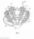 Fig. 02 - Systems and methods to gather and analyze electroencephalographic data