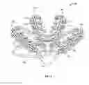 Fig. 03 - Systems and methods to gather and analyze electroencephalographic data