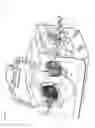 Fig. 07 - Method and apparatus for adjustable earpieces in an MRI system