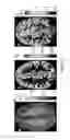 Fig. 04 - High-resolution metabolic neuroimaging